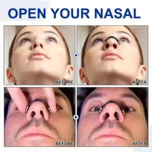 Magnetic Nasal Strips